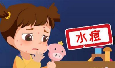 ​水痘进入高发时期 怎么