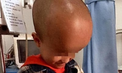 ​15年前，第一个曝光三鹿